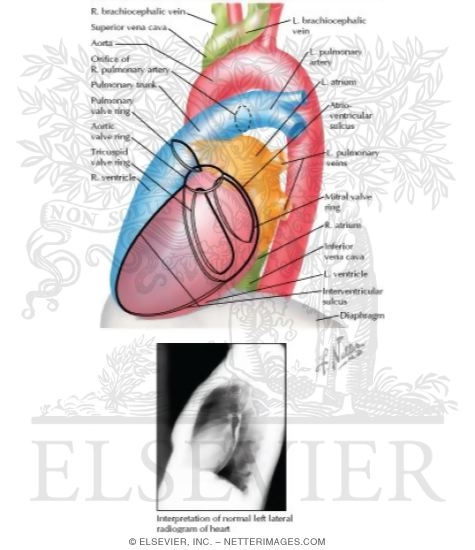 Watermarked preview of labeled image: Radiology and Angiocardiography