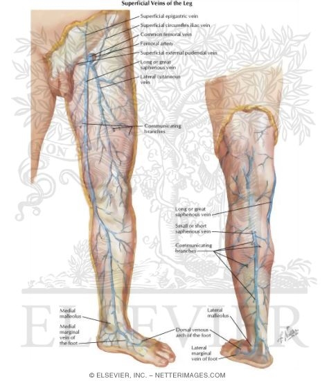 Venous Disorders of Lower Extremity