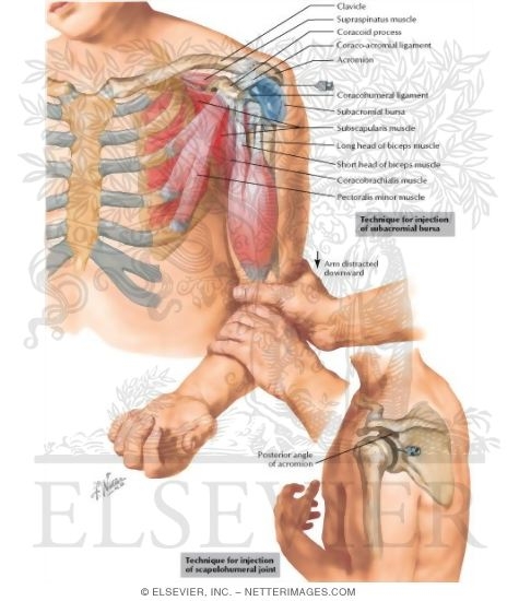 Watermarked preview of labeled image: The Shoulder