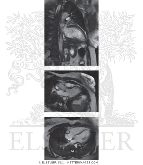 Magnetic Resonance Imaging of the Heart In Arbitrary Orientation
