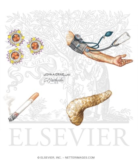Watermarked preview of unlabeled image: Risk Factors In Coronary Heart Disease