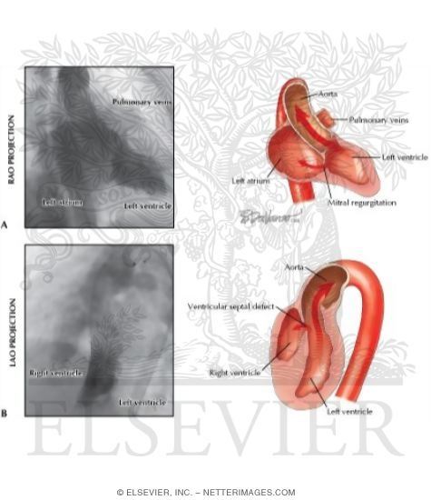 Watermarked preview of unlabeled image: Contrast Injection