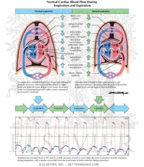 Normal Cardiac Blood Flow During Inspiration and Expiration