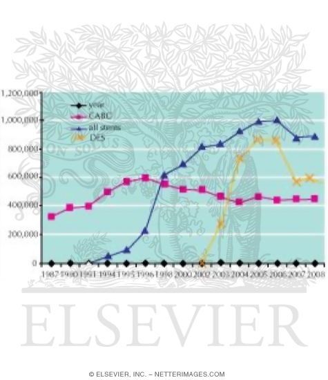 Watermarked preview of unlabeled image: Number of Patients Undergoing Coronary Bypass Surgery and Coronary Stent Procedures In the United States 1987-2008