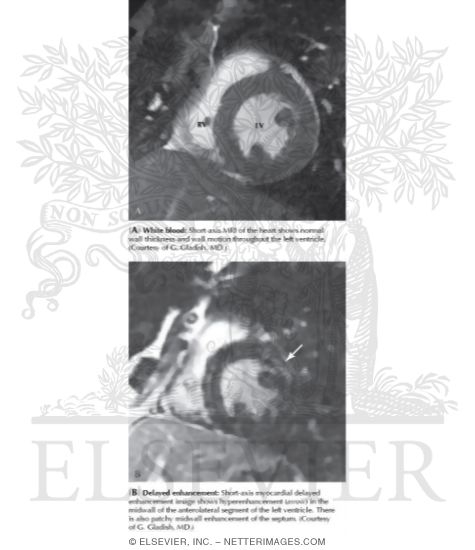 Watermarked preview of unlabeled image: Short-axis Imaging