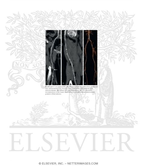 Watermarked preview of unlabeled image: Rotational CT Reconstruction