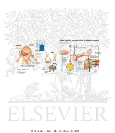 Watermarked preview of labeled image: Metabolic Syndrome