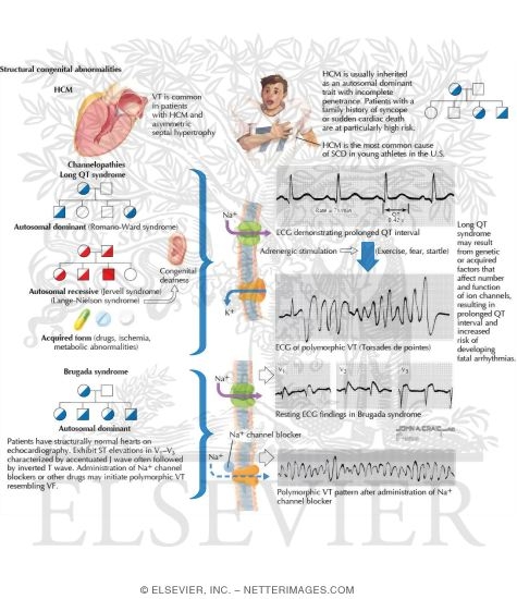 Sudden Cardiac Death