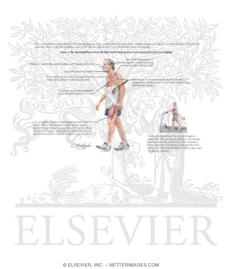 Watermarked preview of labeled image: Exercise Training in Congestive Heart Failure