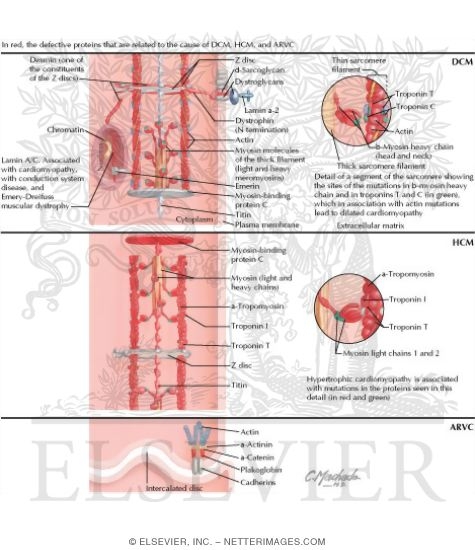 Watermarked preview of labeled image: Interaction of Affected Proteins in DCM, HCM, and ARVC (Cardiac Muscle Cell)