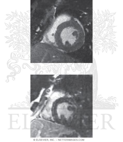 Short-axis Imaging