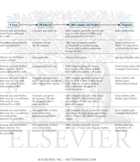 Watermarked preview of unlabeled image: Diagnostic Algorithm for Bradyarrhythmias