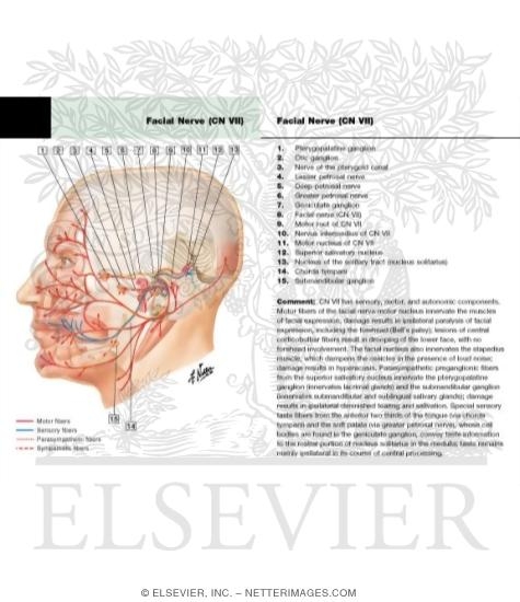 Watermarked preview of labeled image: Facial nerve (VII)