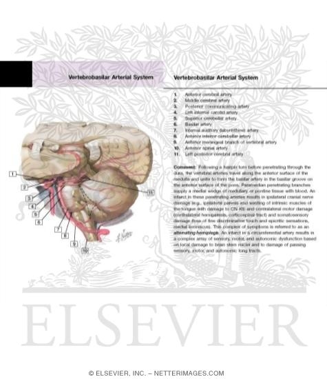 Watermarked preview of labeled image: Arteries of Posterior Cranial Fossa