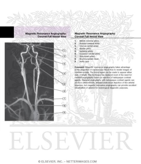 Magnetic Resonance Angiography: Frontal and Lateral Views