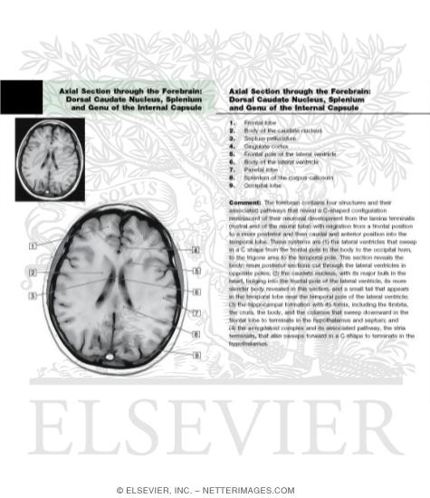 Axial (Horizontal) Sections Through the Forebrain: Level 8 - Dorsal Caudate, Splenium, and Genu of Corpus Callosum