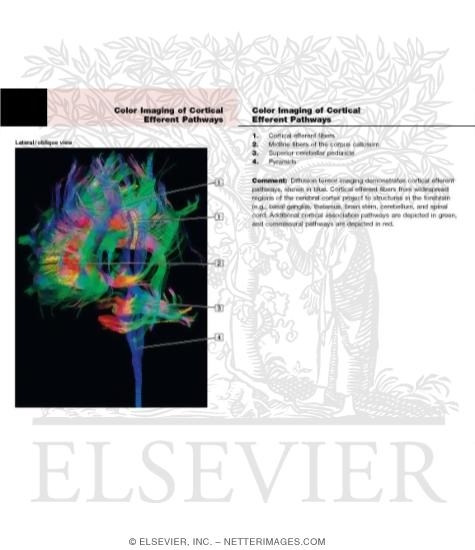 Watermarked preview of labeled image: Color Imaging of Cortical Efferent Pathways