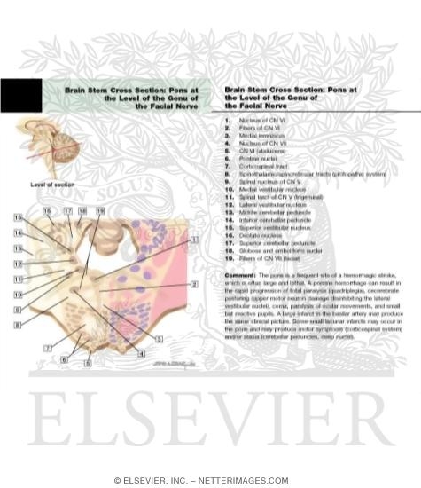 Pons - Level of the Genu of the Facial Nerve