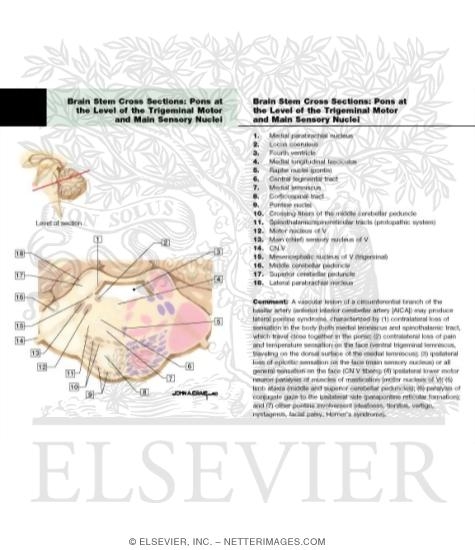 Watermarked preview of labeled image: Pons - Level of Trigeminal Motor and Main Sensory Nuclei