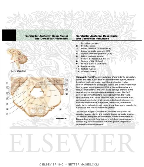 Watermarked preview of labeled image: Cerebellar Anatomy: Deep Nuclei and Cerebellar Peduncles