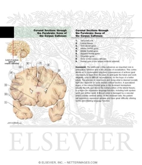 Coronal Sections Through the Forebrain: Genu of Corpus Callosum