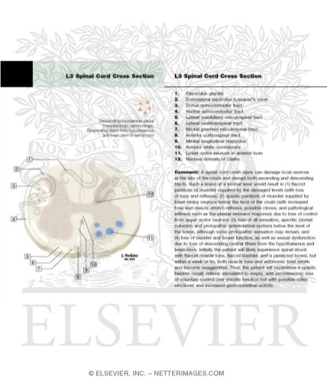 Watermarked preview of labeled image: Spinal Cord Levels: Lumbar