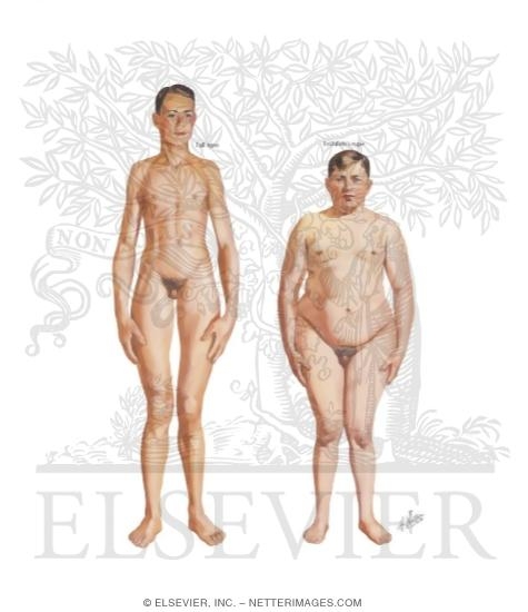 Hypogonadism