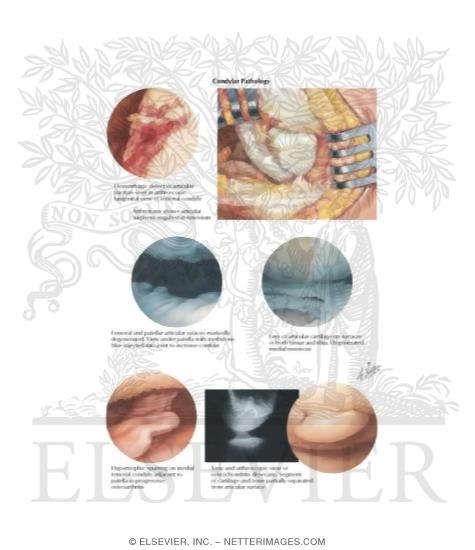 Watermarked preview of labeled image: Condylar Pathology