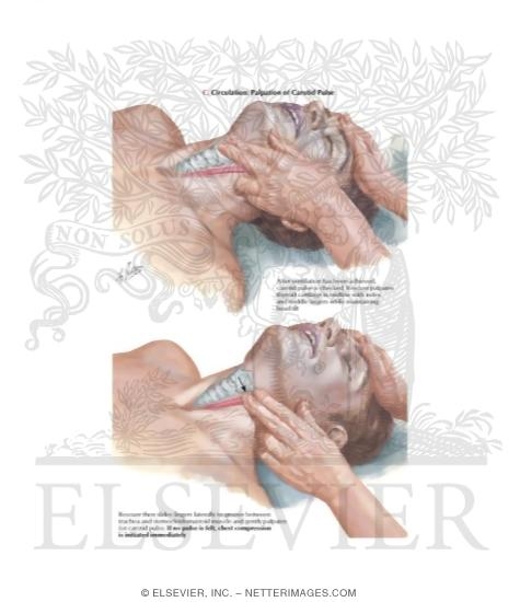 Watermarked preview of labeled image: Circulation: Palpation of Carotid Pulse