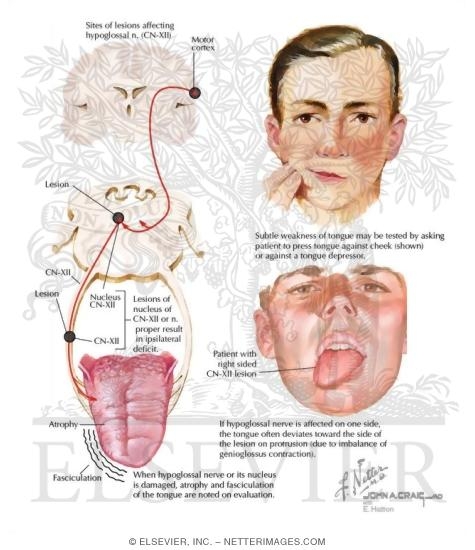 Hypoglossal Nerve (CN-XII)
