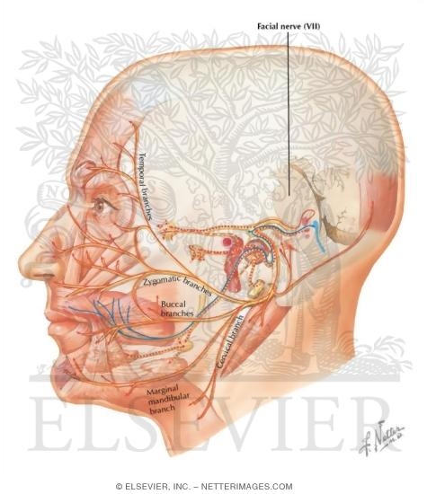 Watermarked preview of labeled image: Facial nerve (VII)