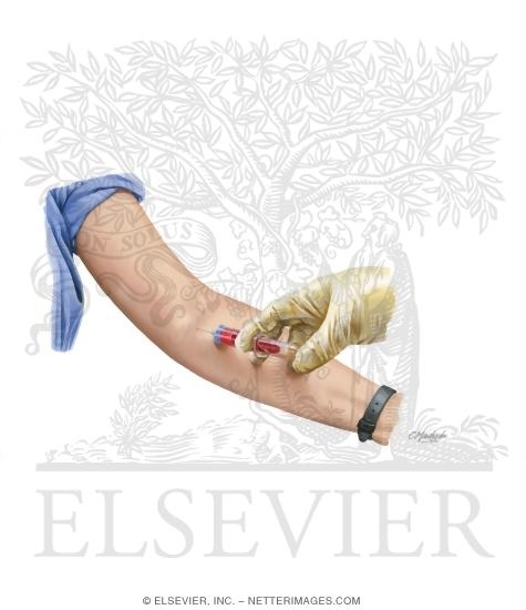Watermarked preview of unlabeled image: Collecting Blood Sample