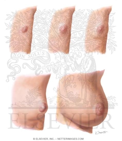 Watermarked preview of unlabeled image: Normal Puberty