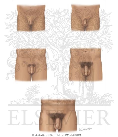 Watermarked preview of unlabeled image: Normal Puberty (Continued)
