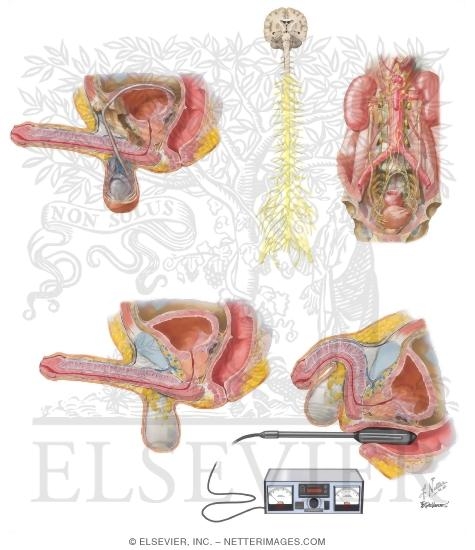 Ejaculatory Disorders