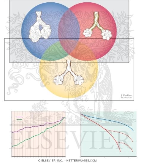 Watermarked preview of unlabeled image: COPD: Clinical Types and Natural History
