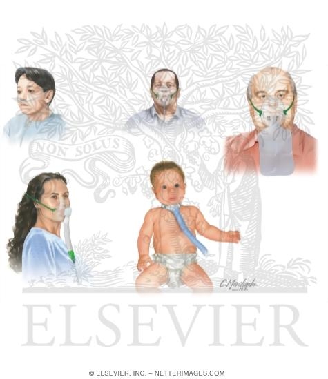 Watermarked preview of unlabeled image: Methods of Oxygen Administration