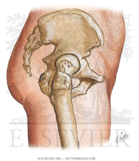 Watermarked preview of unlabeled image: Cross Section Reference Hip: Coronal - Coronal Oblique