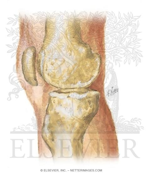 Cross Section Reference Knee: Coronal