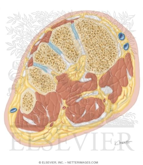 Watermarked preview of unlabeled image: Cross Section of the Ankle and Foot: Coronal View