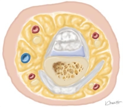 Watermarked preview of unlabeled image: Cross Section of the Hand: Axial View