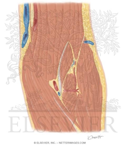 Watermarked preview of unlabeled image: Cross Section of the Elbow: Coronal View