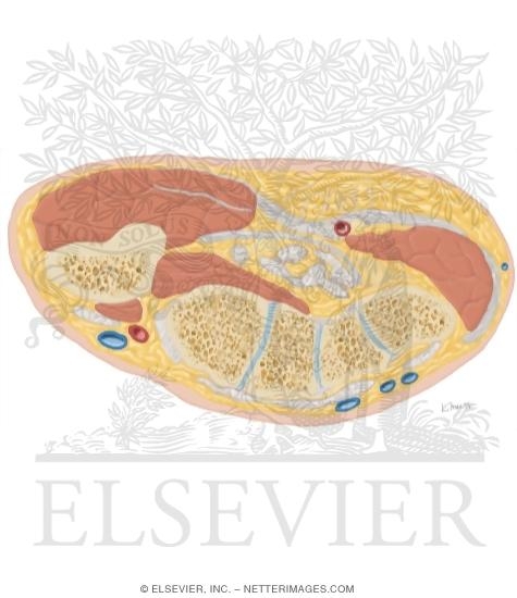 Watermarked preview of unlabeled image: Cross Section of the Hand: Axial View