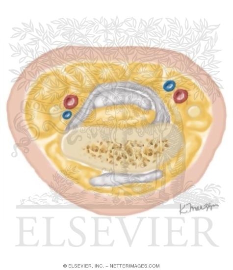 Watermarked preview of unlabeled image: Cross Section of the Hand: Axial View