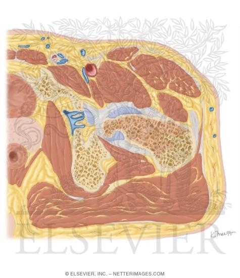 Watermarked preview of unlabeled image: Cross Section of the Hip: Axial View