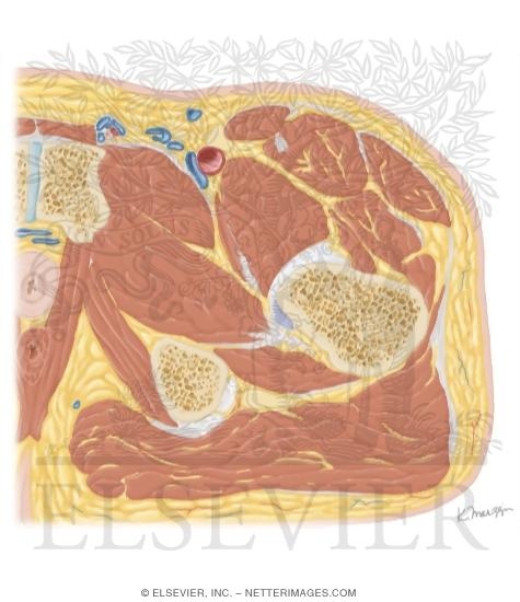 Watermarked preview of unlabeled image: Cross Section of the Hip: Axial View