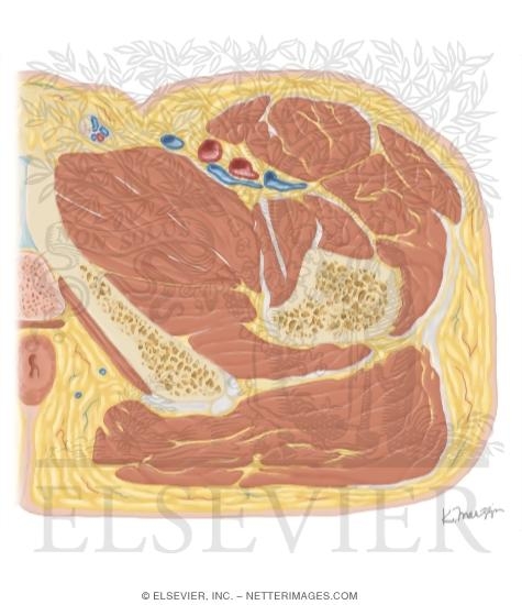 Watermarked preview of unlabeled image: Cross Section of the Hip: Axial View