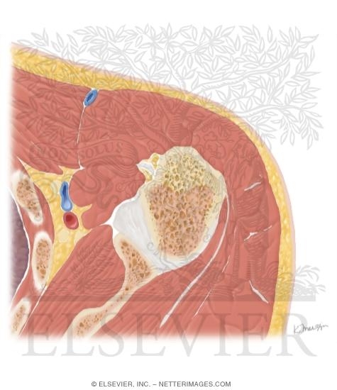 Watermarked preview of unlabeled image: Cross Section of the Shoulder: Axial View