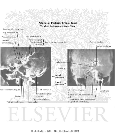 Watermarked preview of labeled image: Angiographic Anatomy of the Vertebrobasilar System
