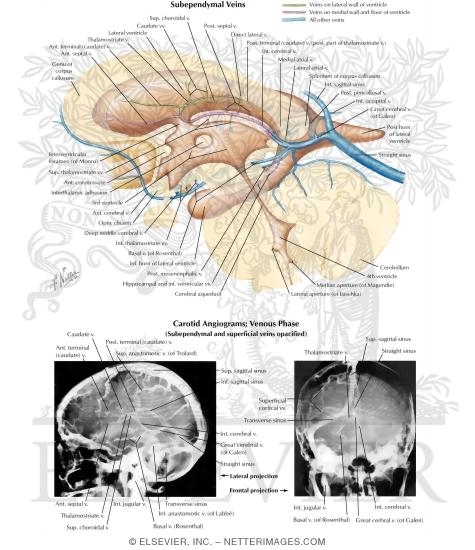 Watermarked preview of labeled image: Subependymal Veins of Brain